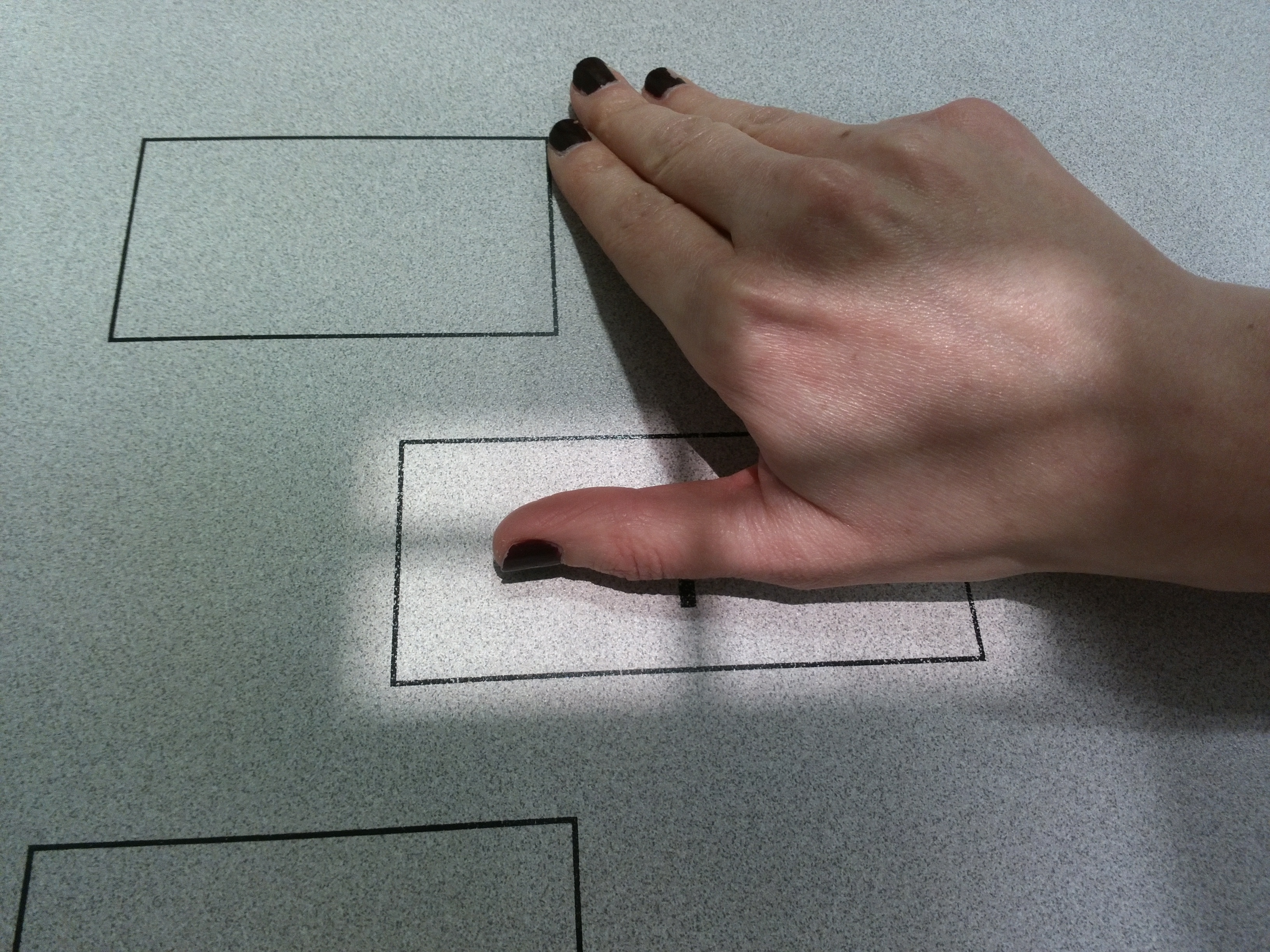 Radiografía lateral pulgar